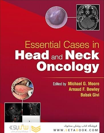 Essential Cases in Head and Neck Oncology 1st Edition