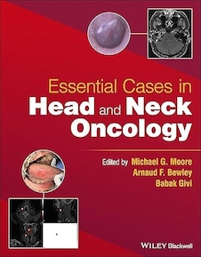 عکس Essential Cases in Head and Neck Oncology 1st Edition