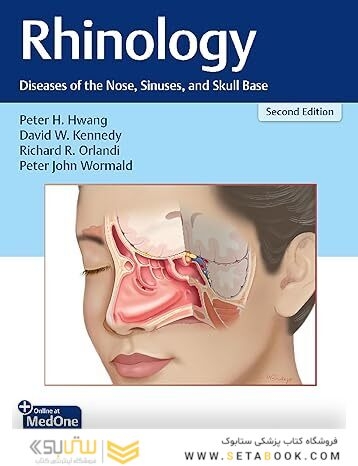 Rhinology: Diseases of the Nose, Sinuses, and Skull Base