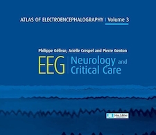 عکس Atlas of Electroencephalography : EEG Neurology and Critical Care. Vol3