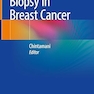 Sentinel Node Biopsy in Breast Cancer 1st ed