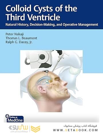 Colloid Cysts of the Third Ventricle: Natural History, Decision-Making, and Operative Management 1st Edition