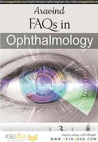 Aravind FAQs in Ophthalmology