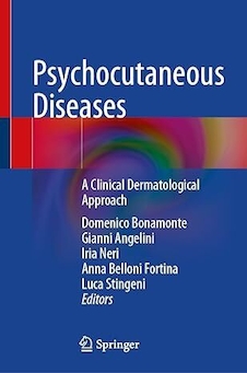 عکس Psychocutaneous Diseases: A Clinical Dermatological Approach