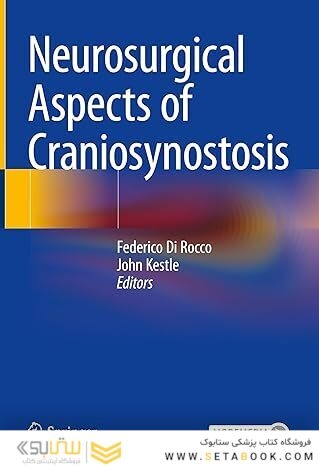 Neurosurgical Aspects of Craniosynostosis