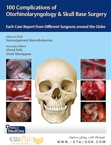 100 Complications of Otorhinolaryngology & Skull Base Surgery: Each Case Report from Different Surgeons Around the Globe