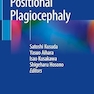 Handbook of Positional Plagiocephaly
