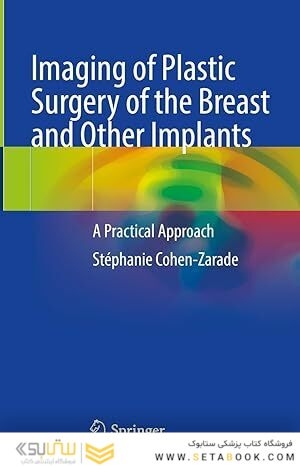 Imaging of Plastic Surgery of the Breast and Other Implants: A Practical Approach
