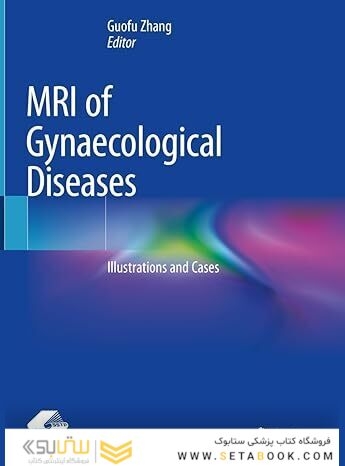 MRI of Gynaecological Diseases: Illustrations and Cases