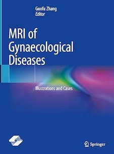 عکس MRI of Gynaecological Diseases: Illustrations and Cases