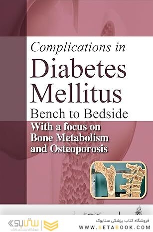 Complications in Diabetes Mellitus: Bench to Bedside with a focus on Bone Metabolism and Osteoporosis