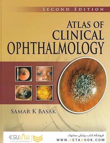 Atlas of Clinical Ophthalmology 2nd Edition