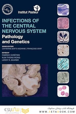 Infections of the Central Nervous System: Pathology and Genetics (International Society of Neuropathology Series) 1st Edition