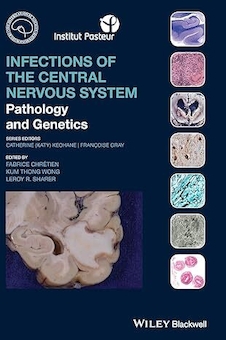عکس Infections of the Central Nervous System: Pathology and Genetics (International Society of Neuropathology Series) 1st Edition