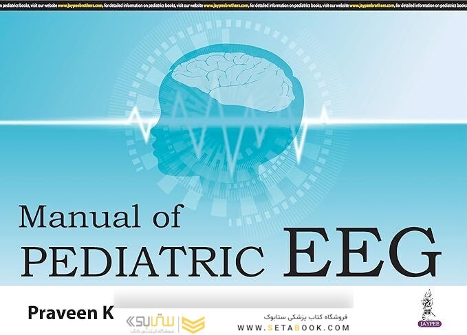 Manual of Pediatric EEG