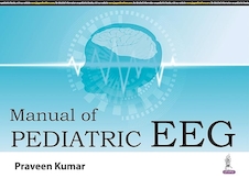 عکس Manual of Pediatric EEG