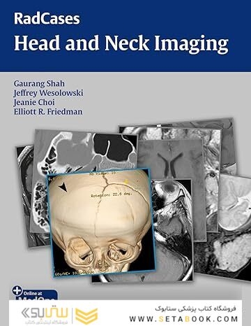 RadCases Head and Neck Imaging 1st Edition