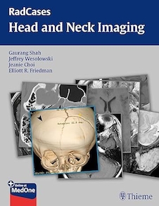 عکس RadCases Head and Neck Imaging 1st Edition
