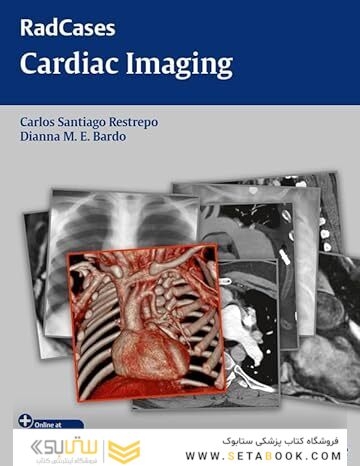 RadCases Cardiac Imaging