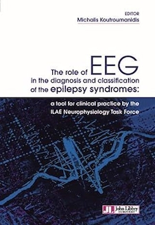 عکس The role of EEG in the diagnosis and classification of the epilepsy syndromes: tool for clinical practice by the ILAE Neurophysiology Task Force