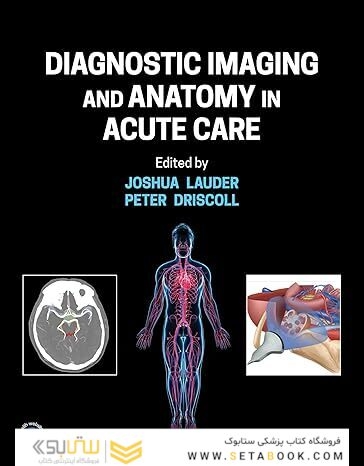 Diagnostic Imaging and Anatomy in Acute Care 1st Edition