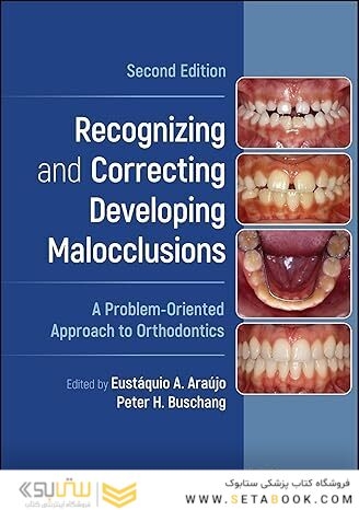 Recognizing and Correcting Developing Malocclusions: A Problem-Oriented Approach to Orthodontics