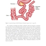 The SAGES Manual of Metabolic and Bariatric Surgery Third Edition