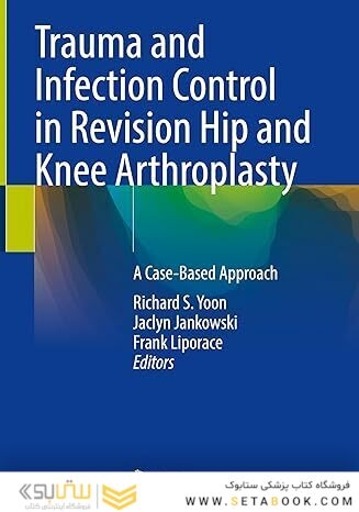 Trauma and Infection Control in Revision Hip and Knee Arthroplasty: A Case-Based Approach