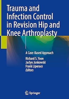 عکس Trauma and Infection Control in Revision Hip and Knee Arthroplasty: A Case-Based Approach