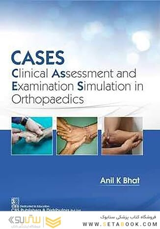 CASES: Clinical Assessment and Examination Simulation in Orthopaedics Bhat, Anil