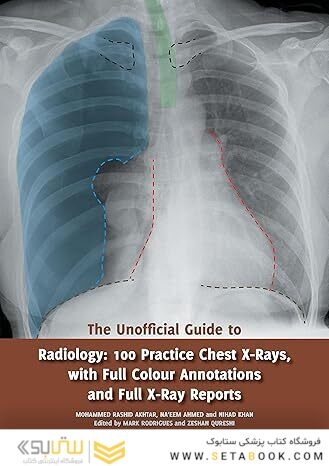 The Unofficial Guide to Radiology: 100 Practice Chest X Rays with Full Colour Annotations and Full X Ray Reports 1st Edition