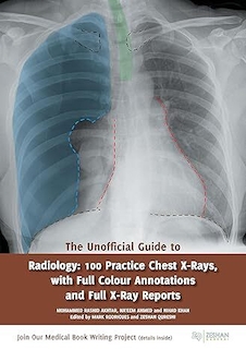 عکس The Unofficial Guide to Radiology: 100 Practice Chest X Rays with Full Colour Annotations and Full X Ray Reports 1st Edition