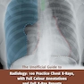 The Unofficial Guide to Radiology: 100 Practice Chest X Rays with Full Colour Annotations and Full X Ray Reports 1st Edition