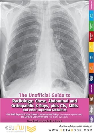 Unofficial Guide to Radiology: Core Radiology Curriculum