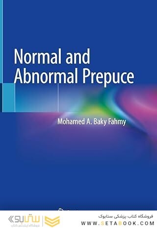 Normal and Abnormal Prepuce 1st ed