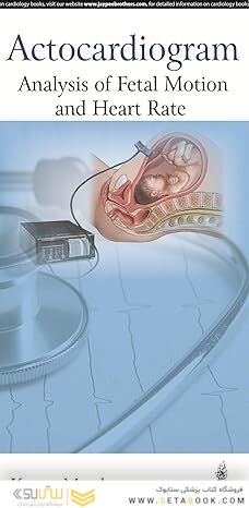 Actocardiogram: Analysis of Fetal Motion and Heart Rate 1st Edition