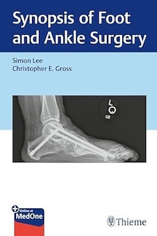 عکس Synopsis of Foot and Ankle Surgery