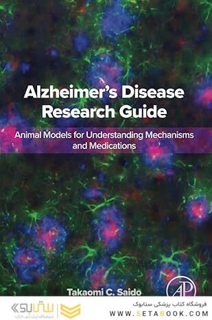 Alzheimer