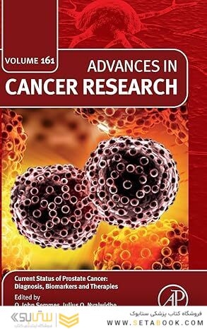Current Status of Prostate Cancer: Diagnosis, Biomarkers and Therapies