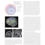 Neuroscience 7th Edition