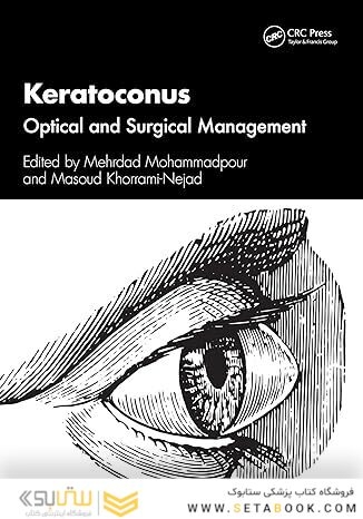 Keratoconus 1st Edition