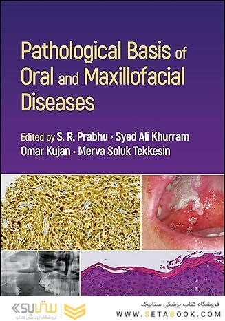 Pathological Basis of Oral and Maxillofacial Diseases 1st Edition