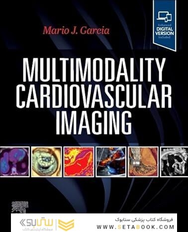 Multimodality Cardiovascular Imaging 1st Edition