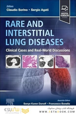 Rare and Interstitial Lung Diseases: Clinical Cases and Real-World Discussions 1st Edition
