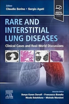 عکس Rare and Interstitial Lung Diseases: Clinical Cases and Real-World Discussions 1st Edition