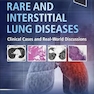 Rare and Interstitial Lung Diseases: Clinical Cases and Real-World Discussions 1st Edition