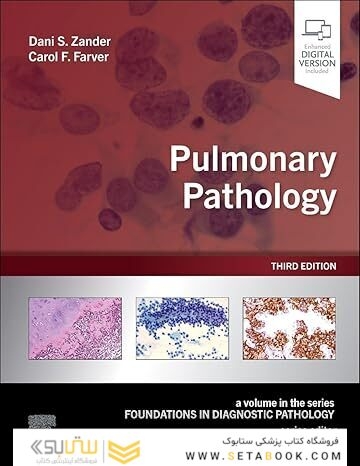 Pulmonary Pathology (Foundations in Diagnostic Pathology) 3rd Edition