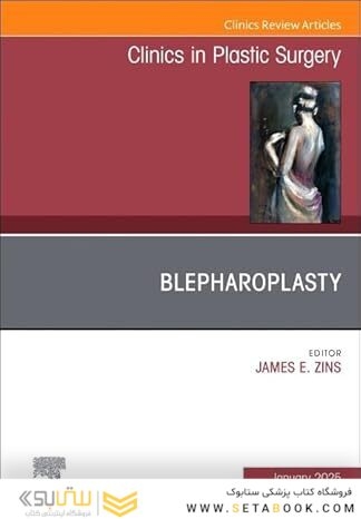 Blepharoplasty, An Issue of Clinics in Plastic Surgery