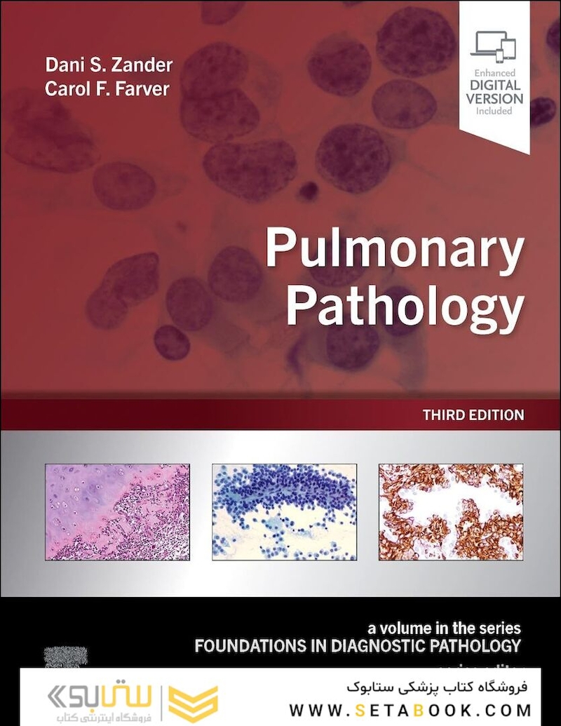 Pulmonary Pathology (Foundations in Diagnostic Pathology) 3rd Edition