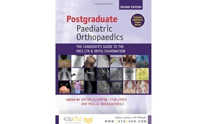 Postgraduate Paediatric Orthopaedics: The Candidate